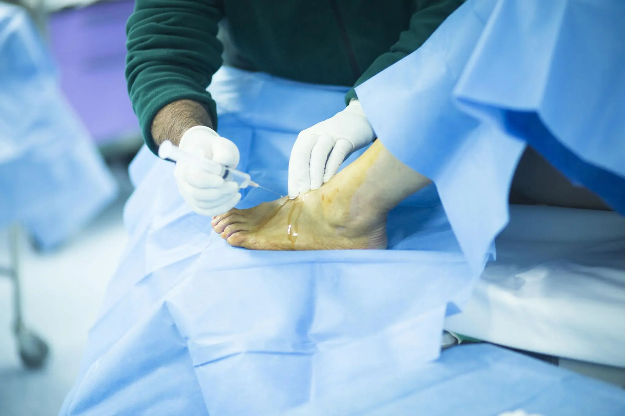 foot surgery in livingston, nj