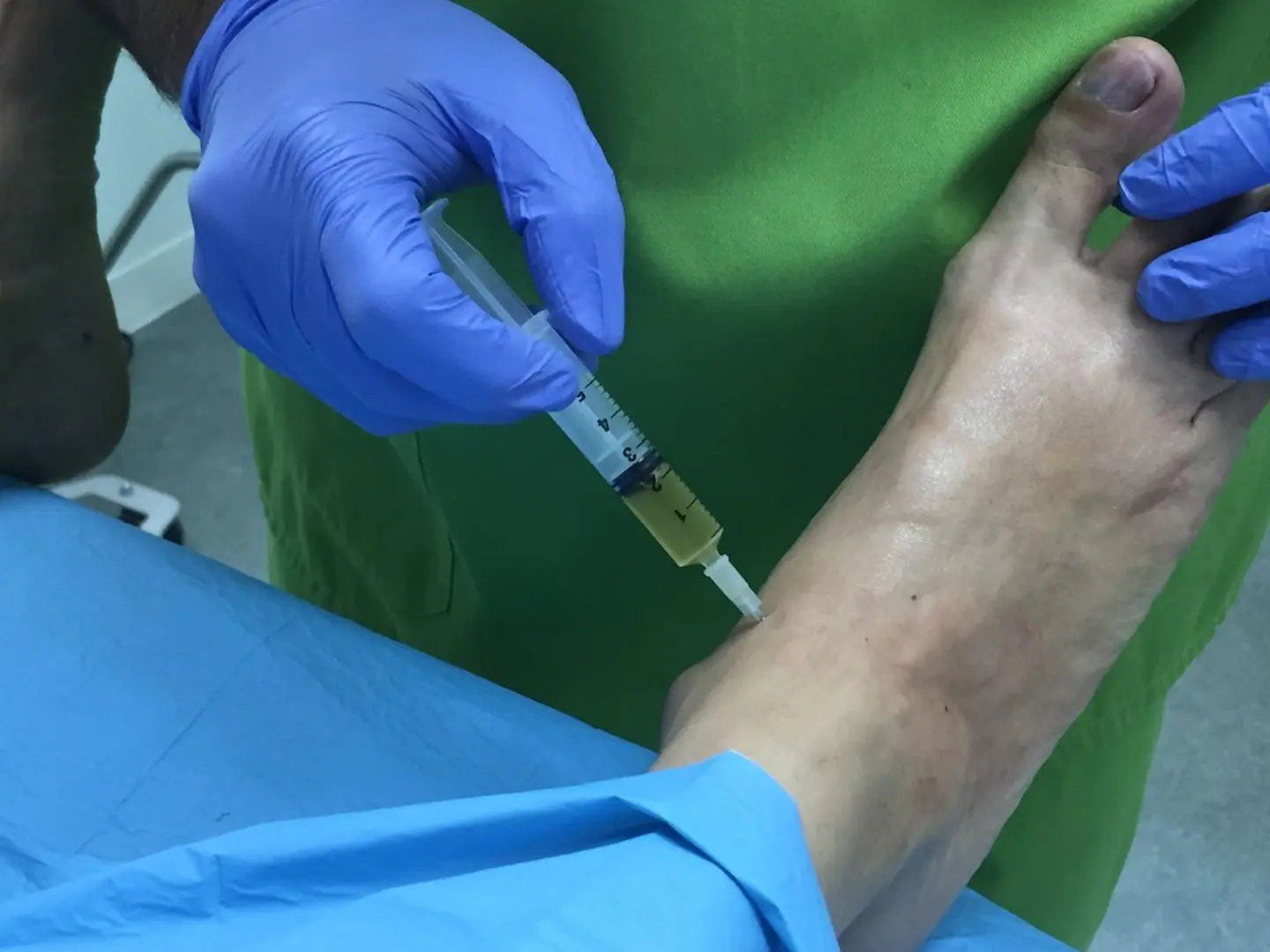 regenerative medicine in livingston, nj